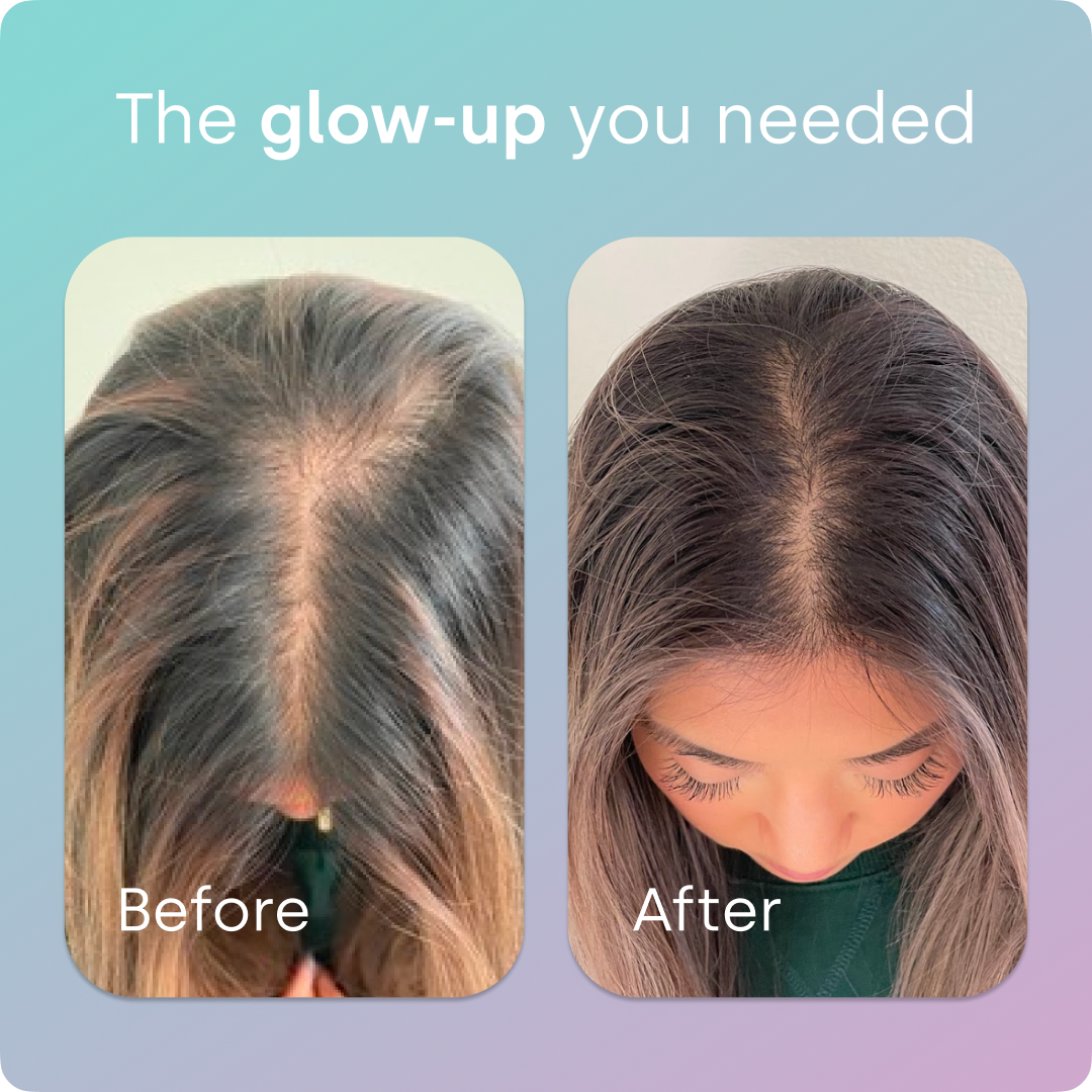 BioSil Advanced Hair & Nail Care — alternate view