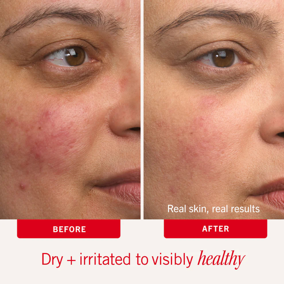 First Aid Beauty Ultra Repair Intense Hydration — alternate view